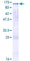 12.5% SDS-PAGE Stained with Coomassie Blue.